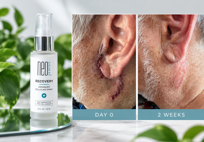 NeoGenesis Recovery Serum Review (2026): Is 70% S2RM Worth It? Results, How to Use, Canada Pricing