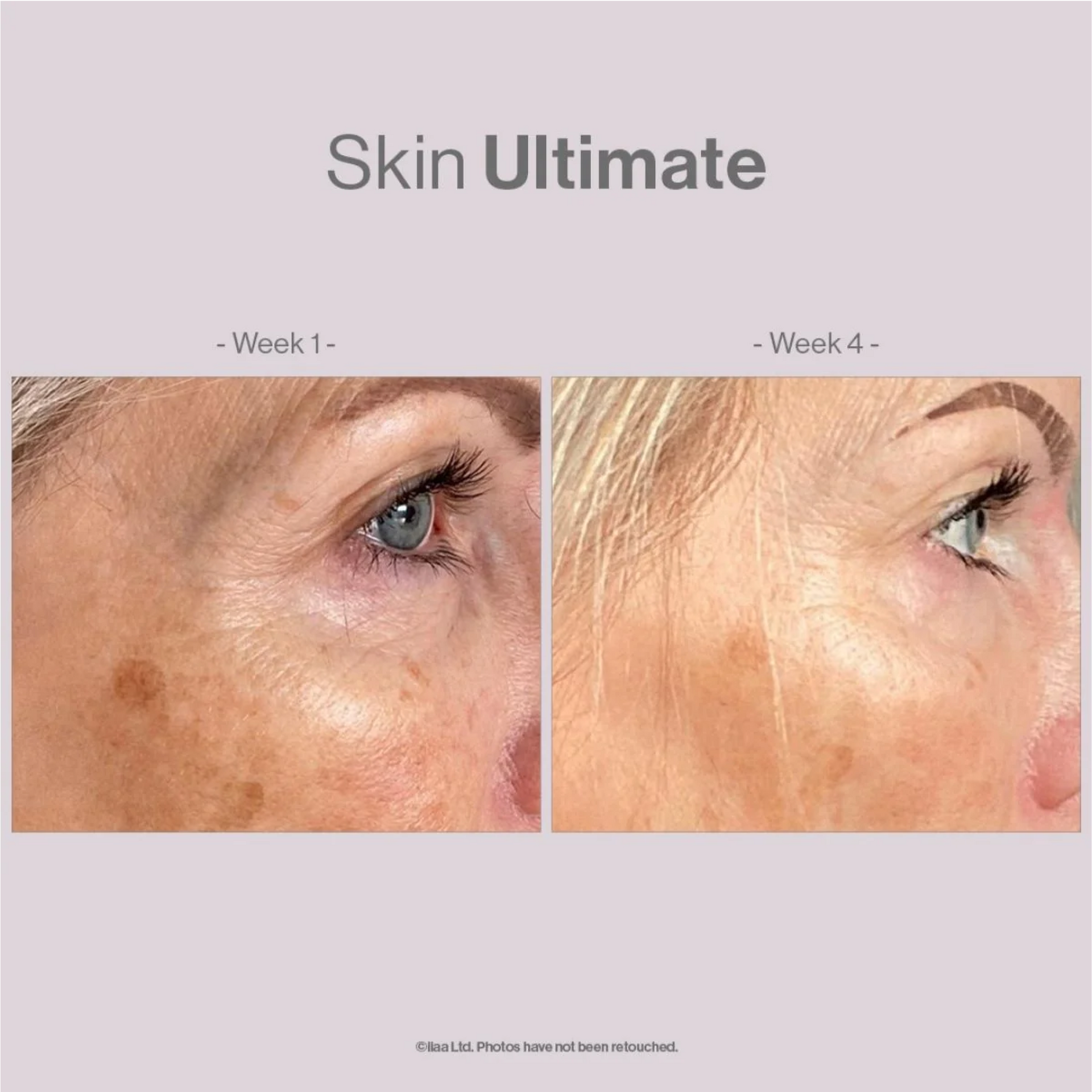 Advanced Nutrition Programme Skin Ultimate (28 Pods of Beauty)