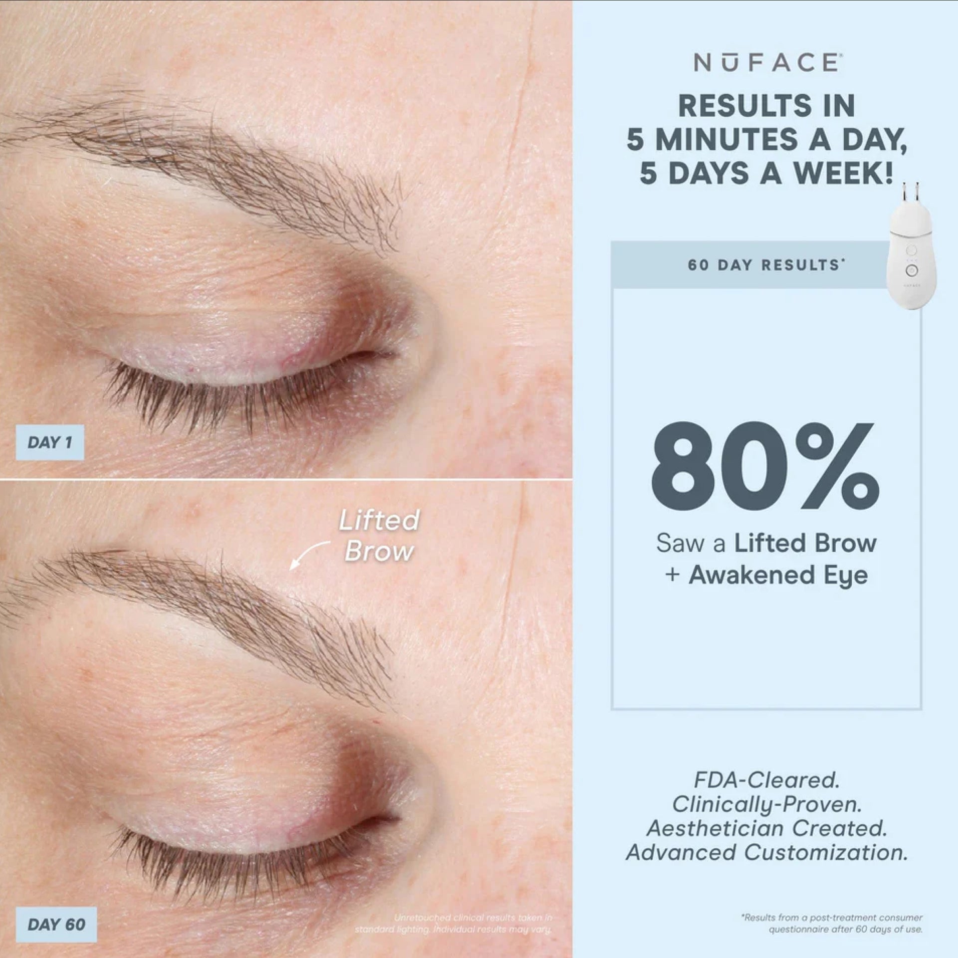 NuFACE Trinity+ Pro ELE Attachment