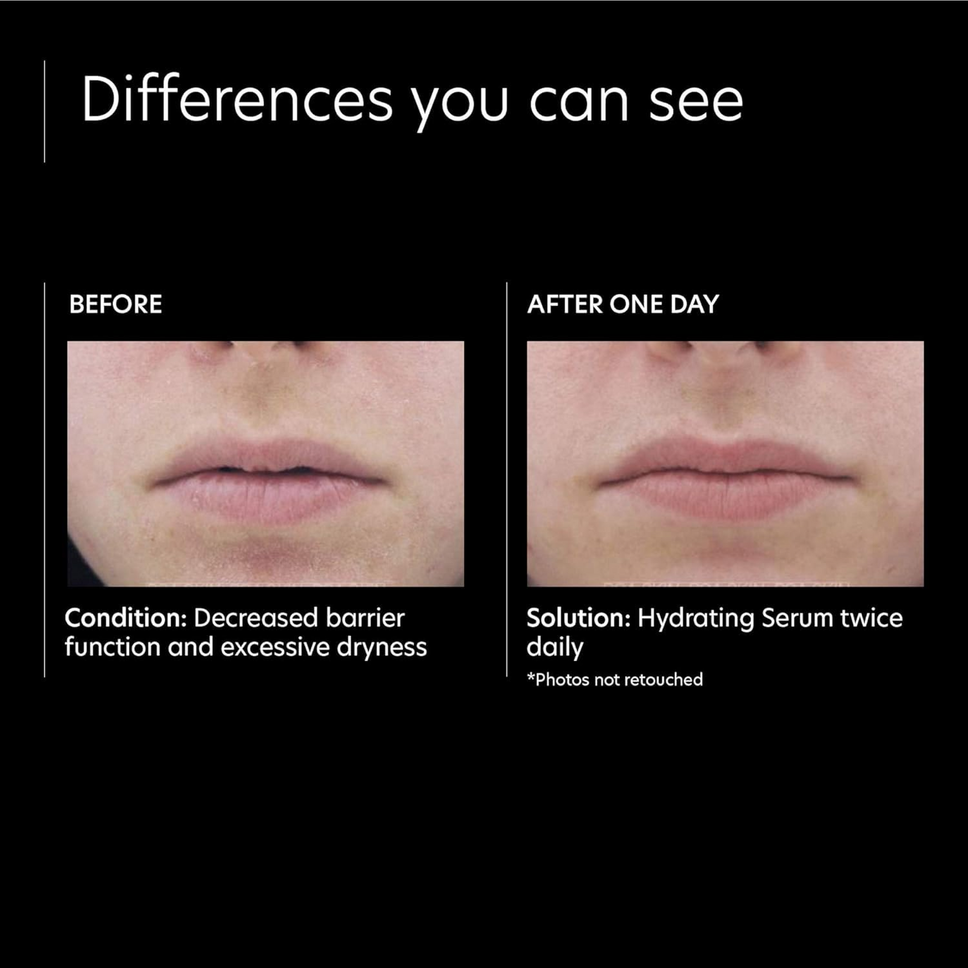 PCA Skin Hydrating Serum