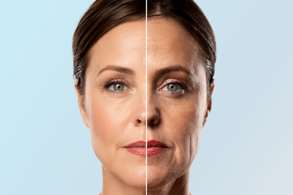 Ozempic Face: The Honest Skincare Guide for GLP-1 Users (Canada, 2026)