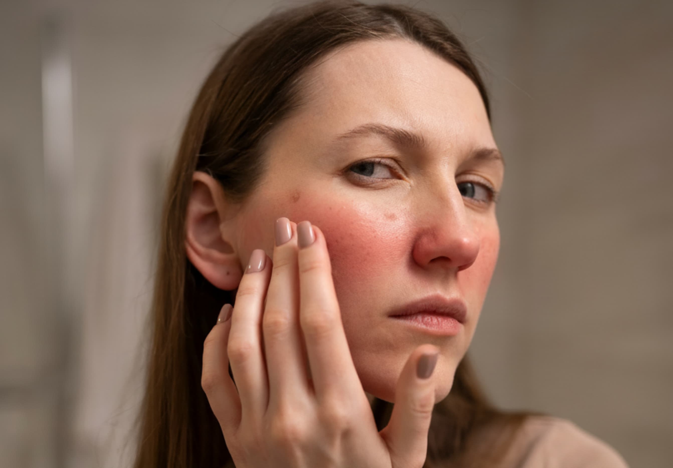 Rosacea Skincare Guide: Causes, Triggers & Best Products