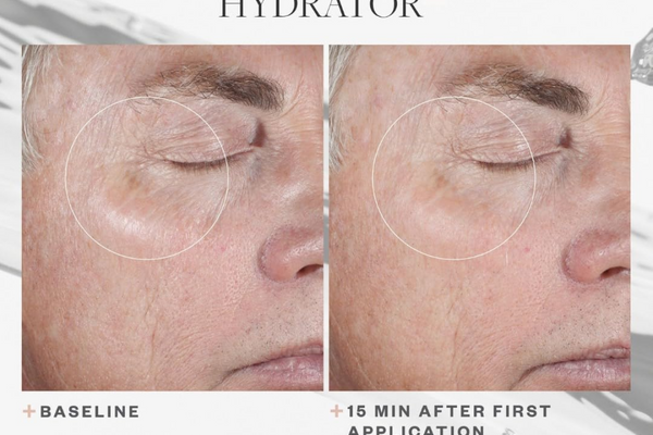 Le protocole Plump : 3 sérums hydratants de qualité médicale qui comblent réellement les rides