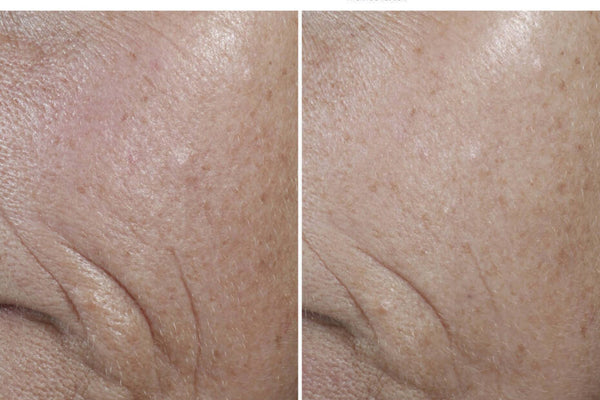 Revue SkinCeuticals CE Ferulic : Analyse clinique approfondie de la vitamine C (2026)