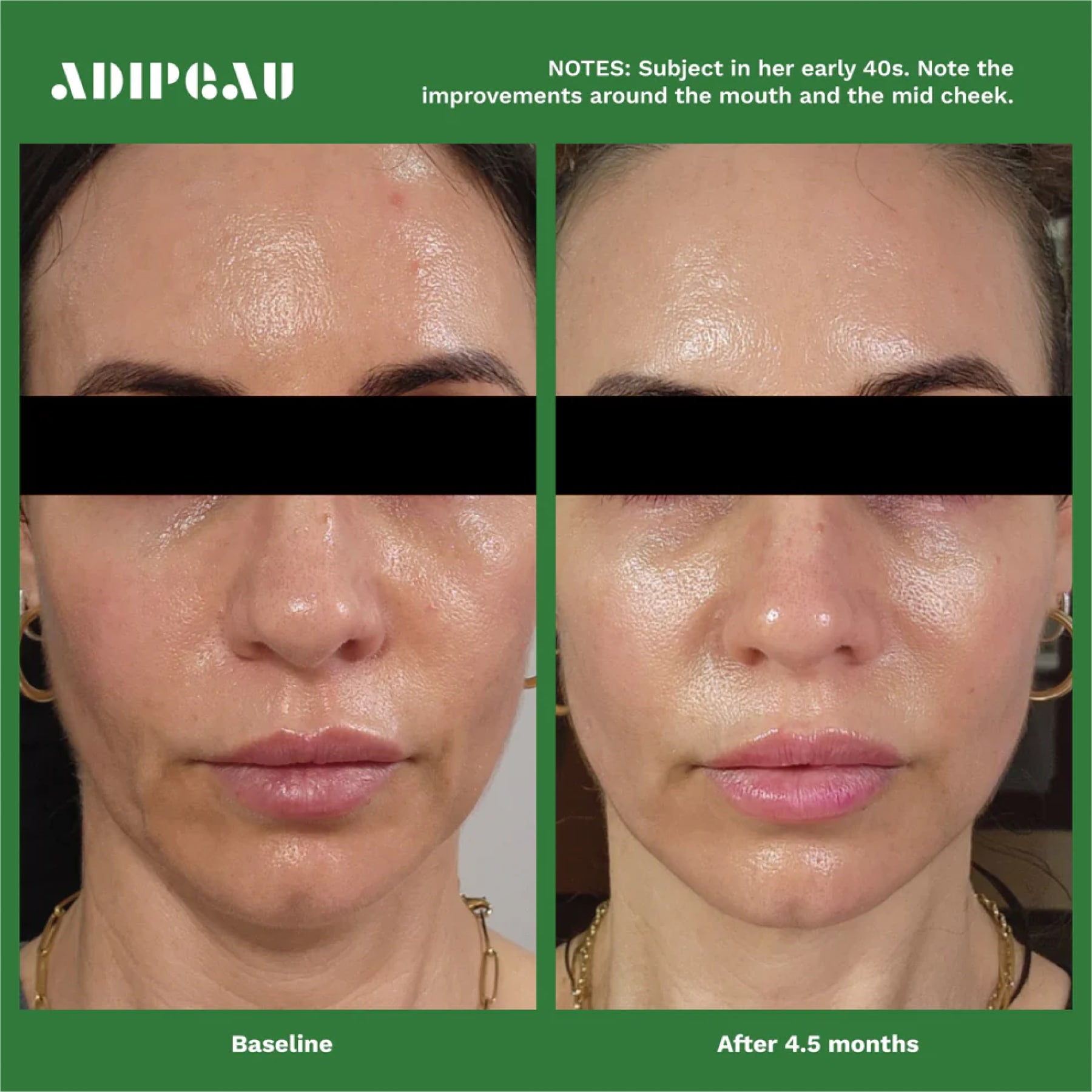 Adipeau Active Face Cream Travel Pack (12 sachets)