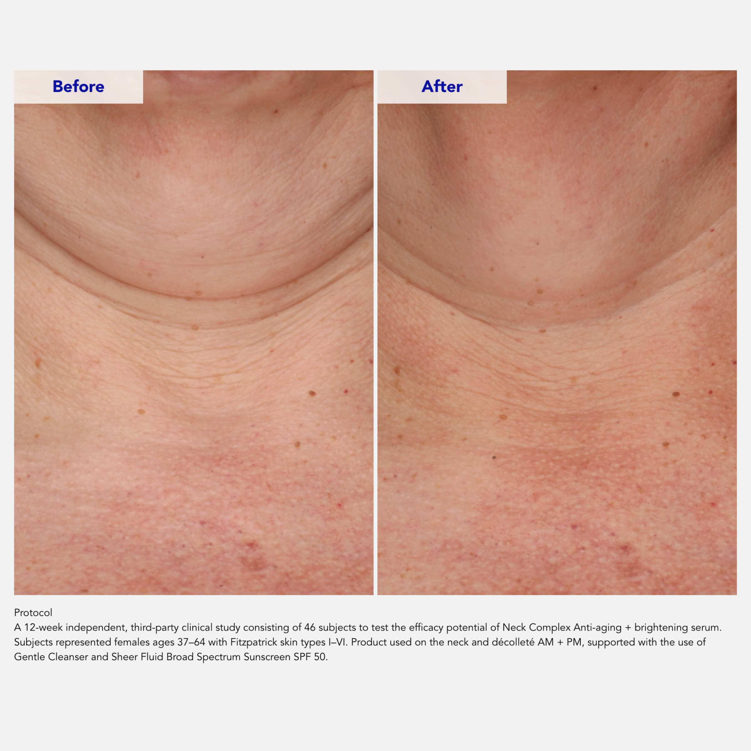 NACC KIO SPセラム ZO Neck Complex Serum | Anti-Aging & Brightening Care