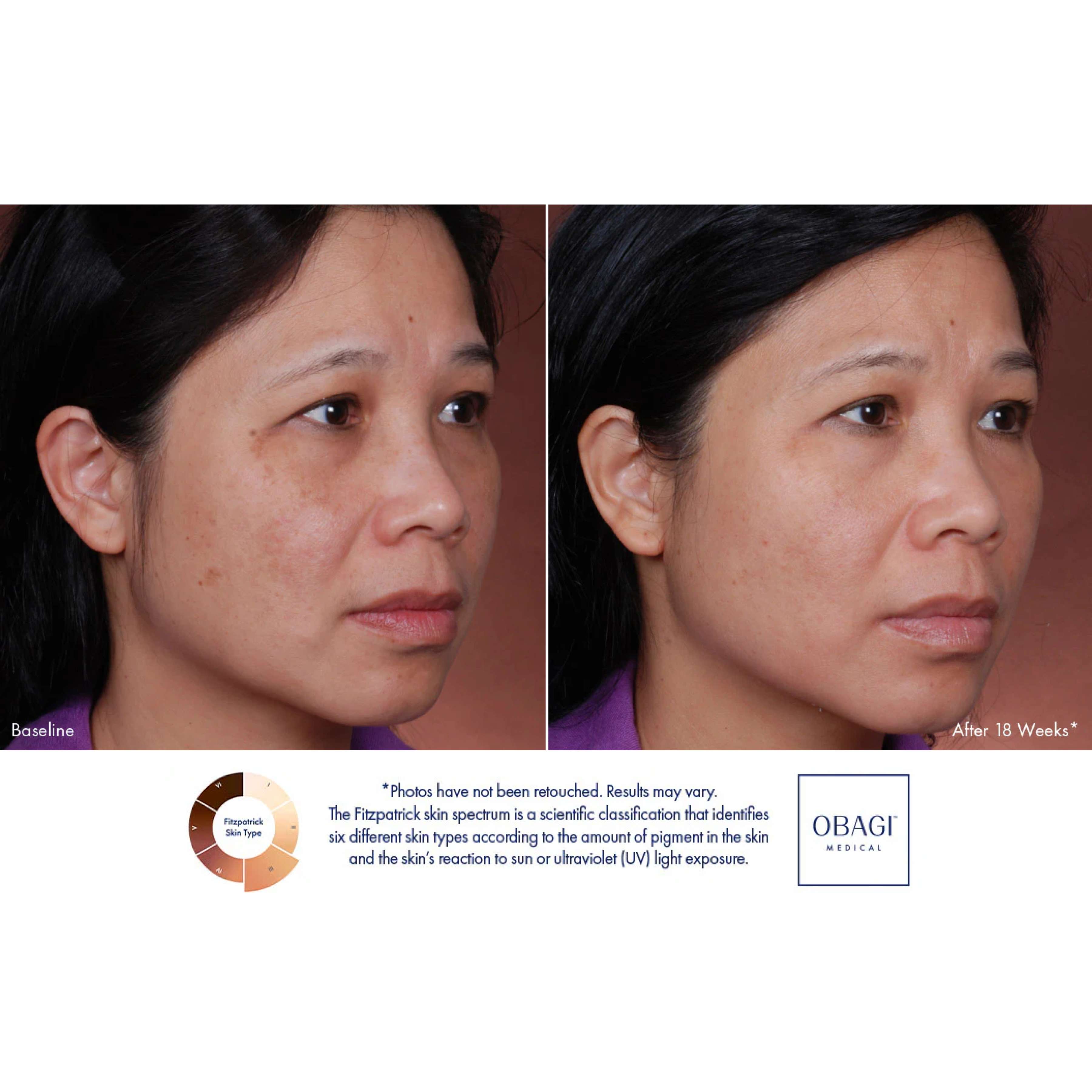 Obagi Nu-Derm® Blend Fx (57 g)