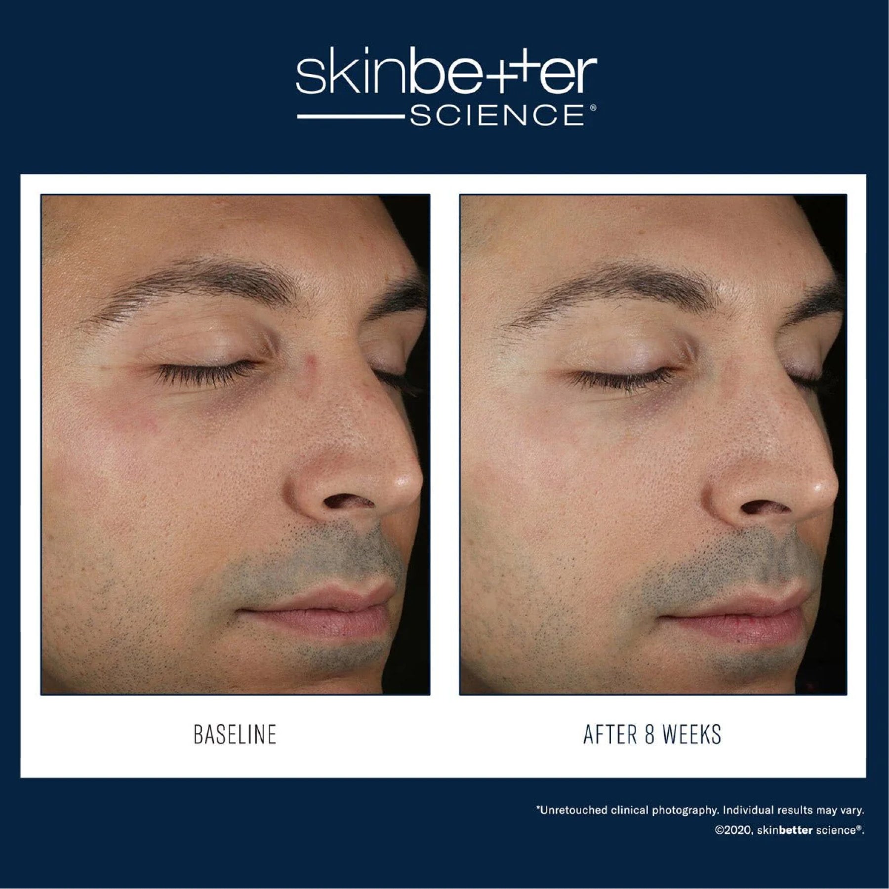 SkinBetter Solo Hydrating Defense Men