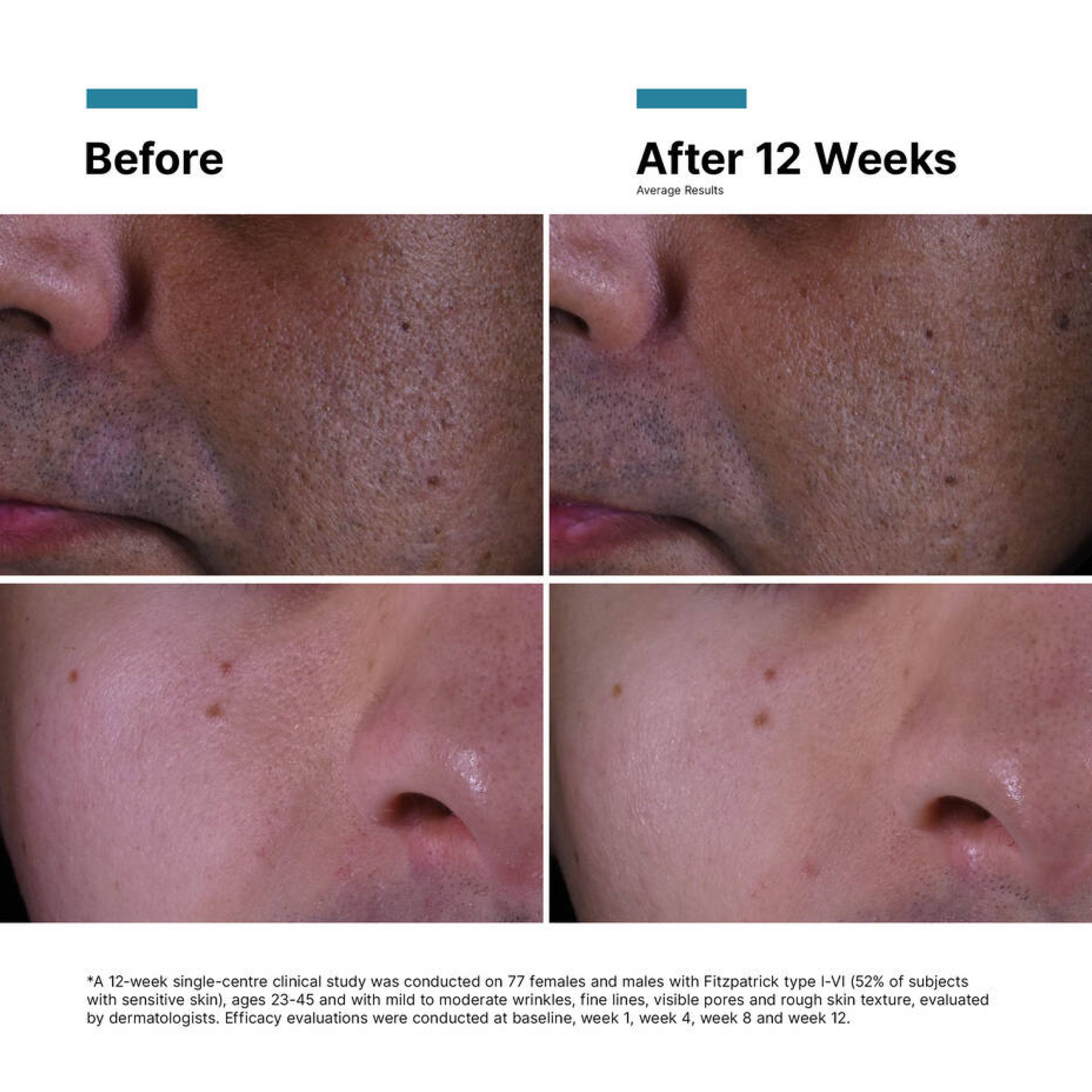 SkinCeuticals P-TIOX Anti-Wrinkle Cream - Travel Size