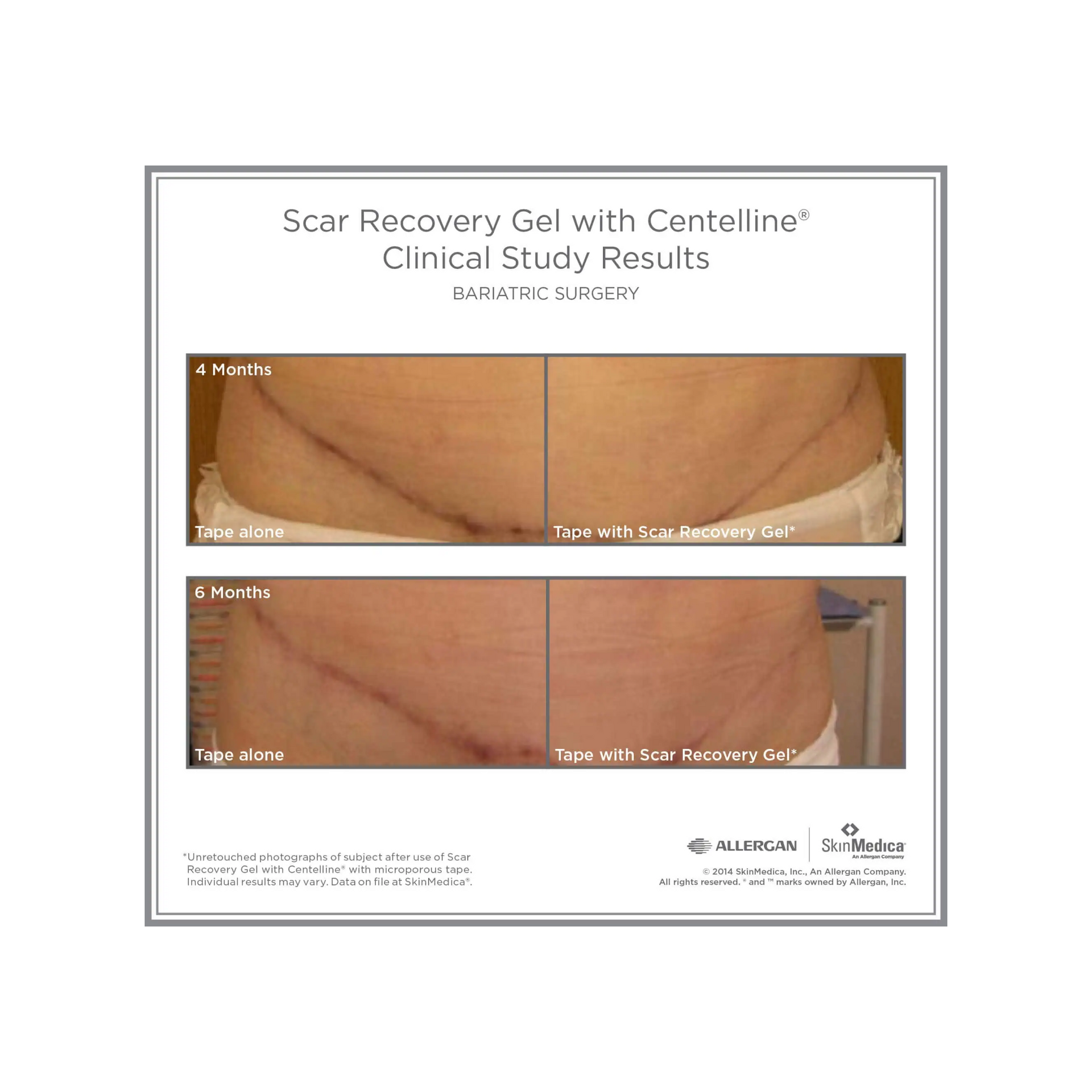 SkinMedica Scar Recovery Gel with Centelline®