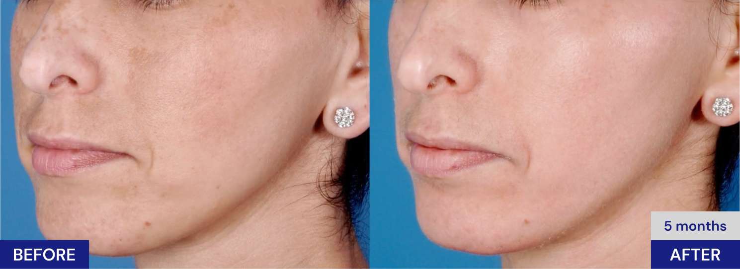 ZO Skin Health Brightalive Skin Brightener (50ml)