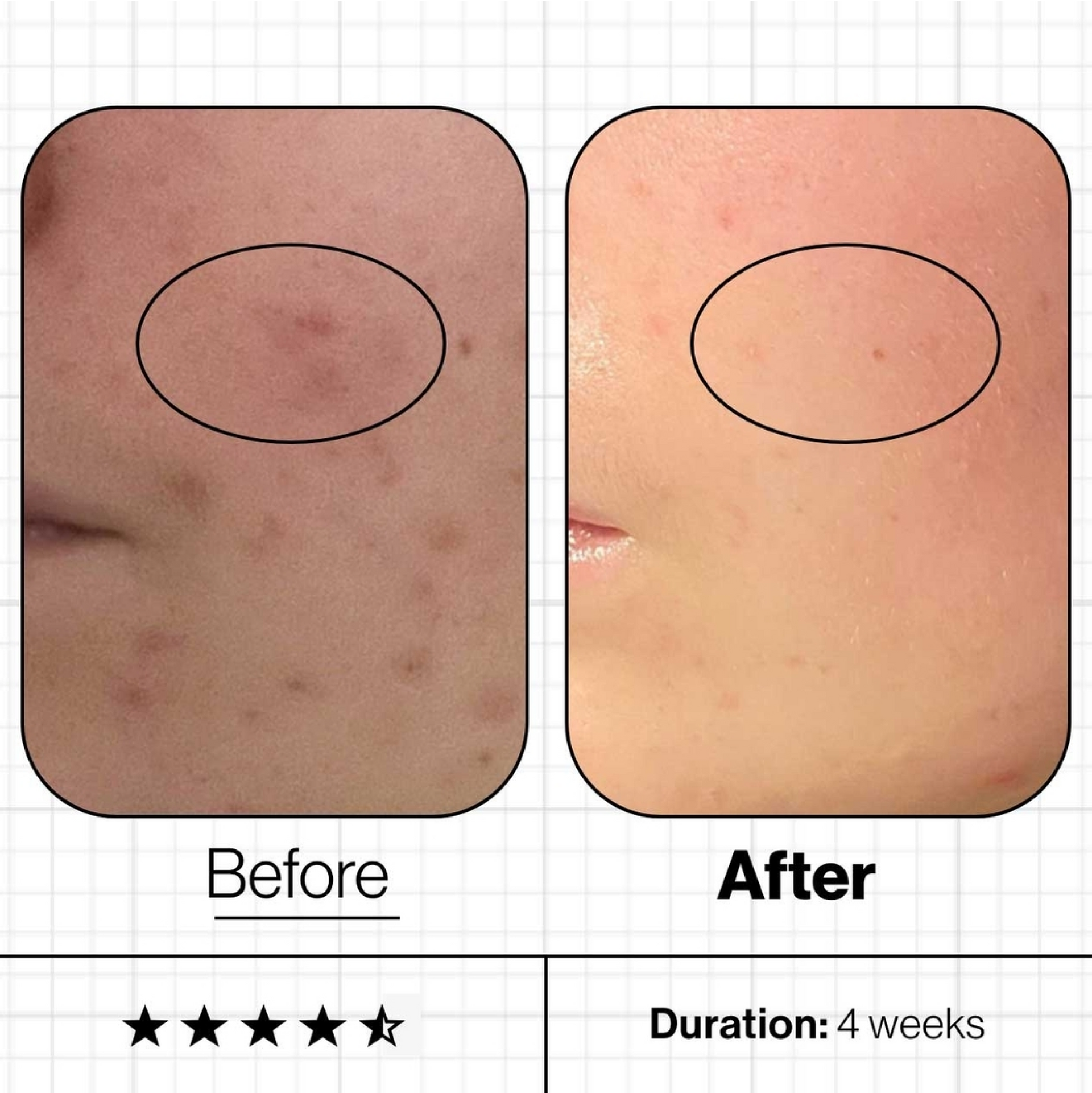 Programme de nutrition avancée SCB4 Skin Clear Biome (60 capsules)