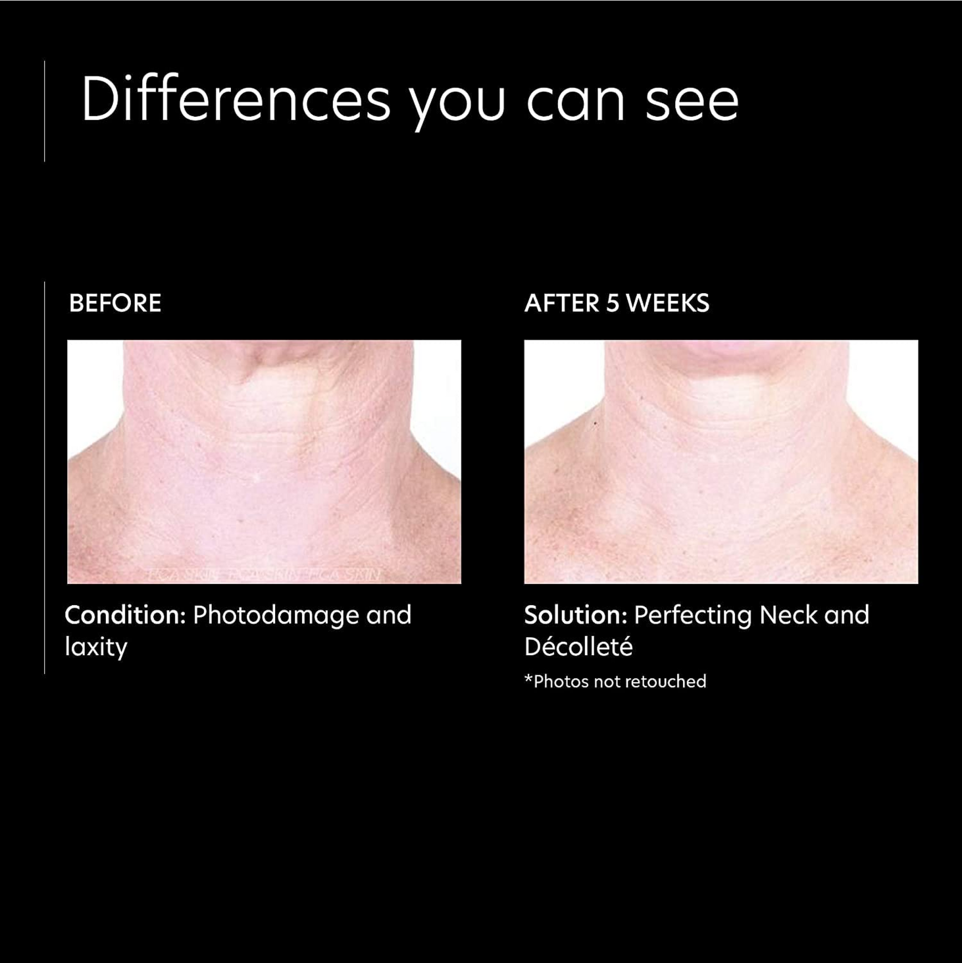 PCA Skin Perfecting Neck & Décolleté