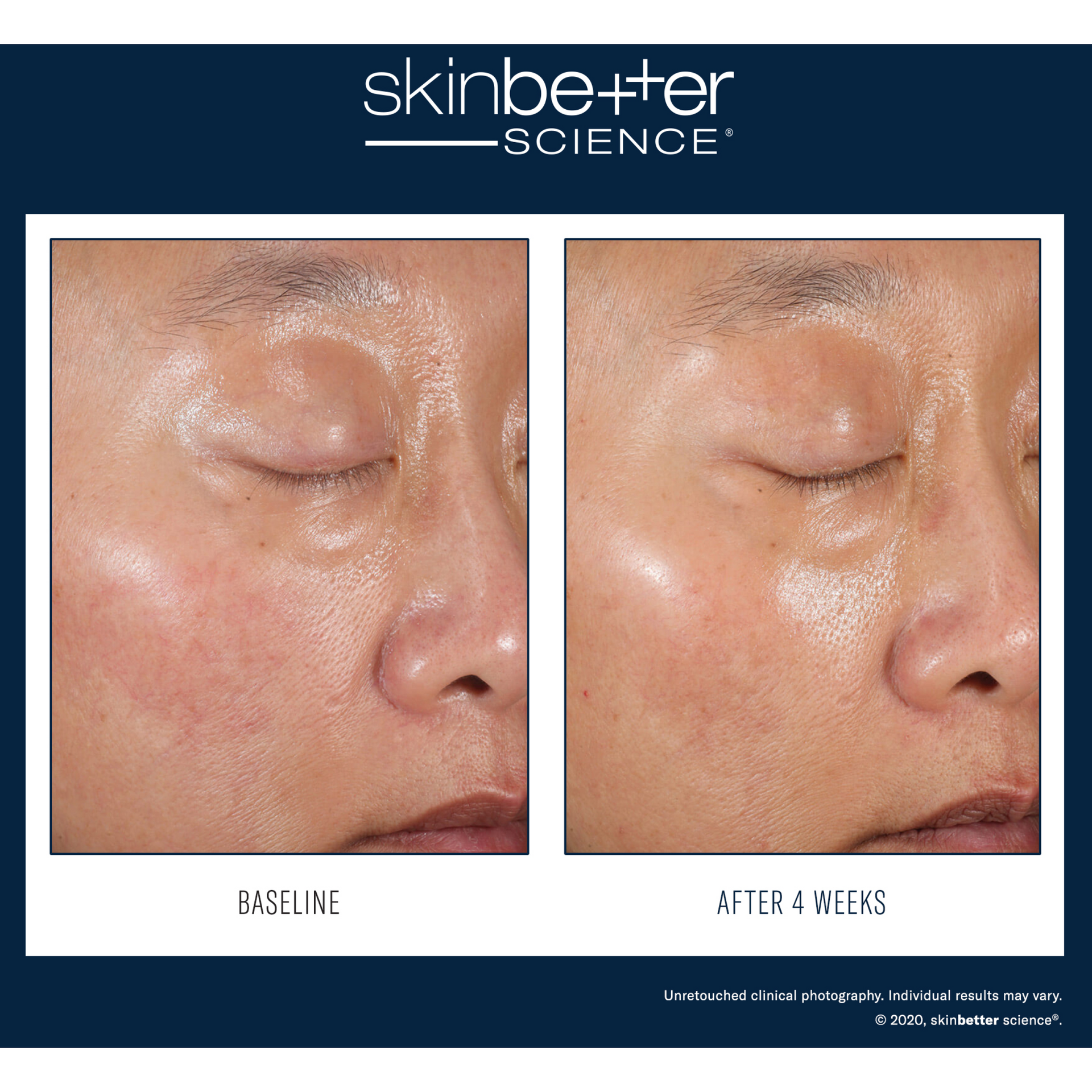 SkinBetter Alto Defense AlphaRet Duo Kit