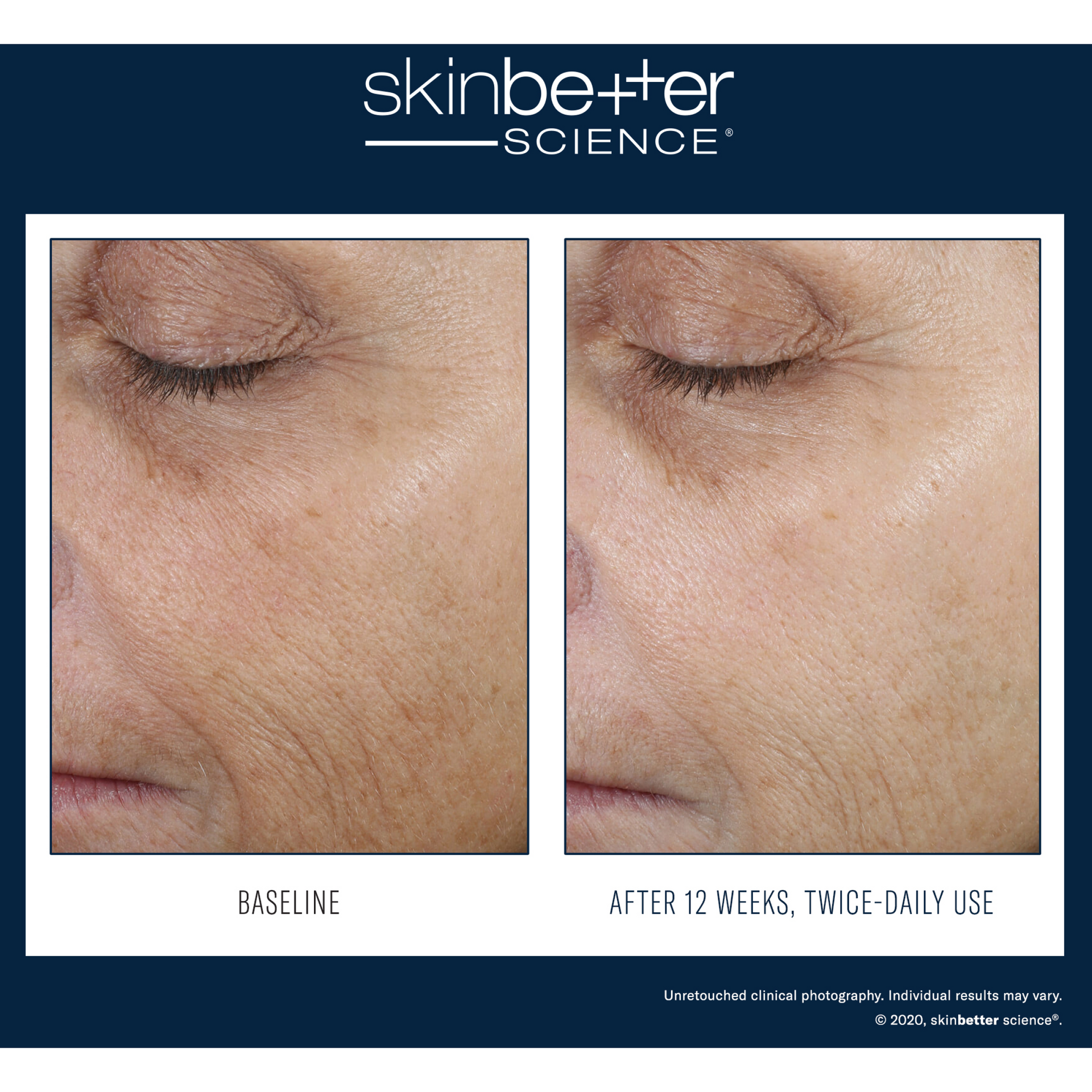 Sérum correcteur de tonus SkinBetter Even