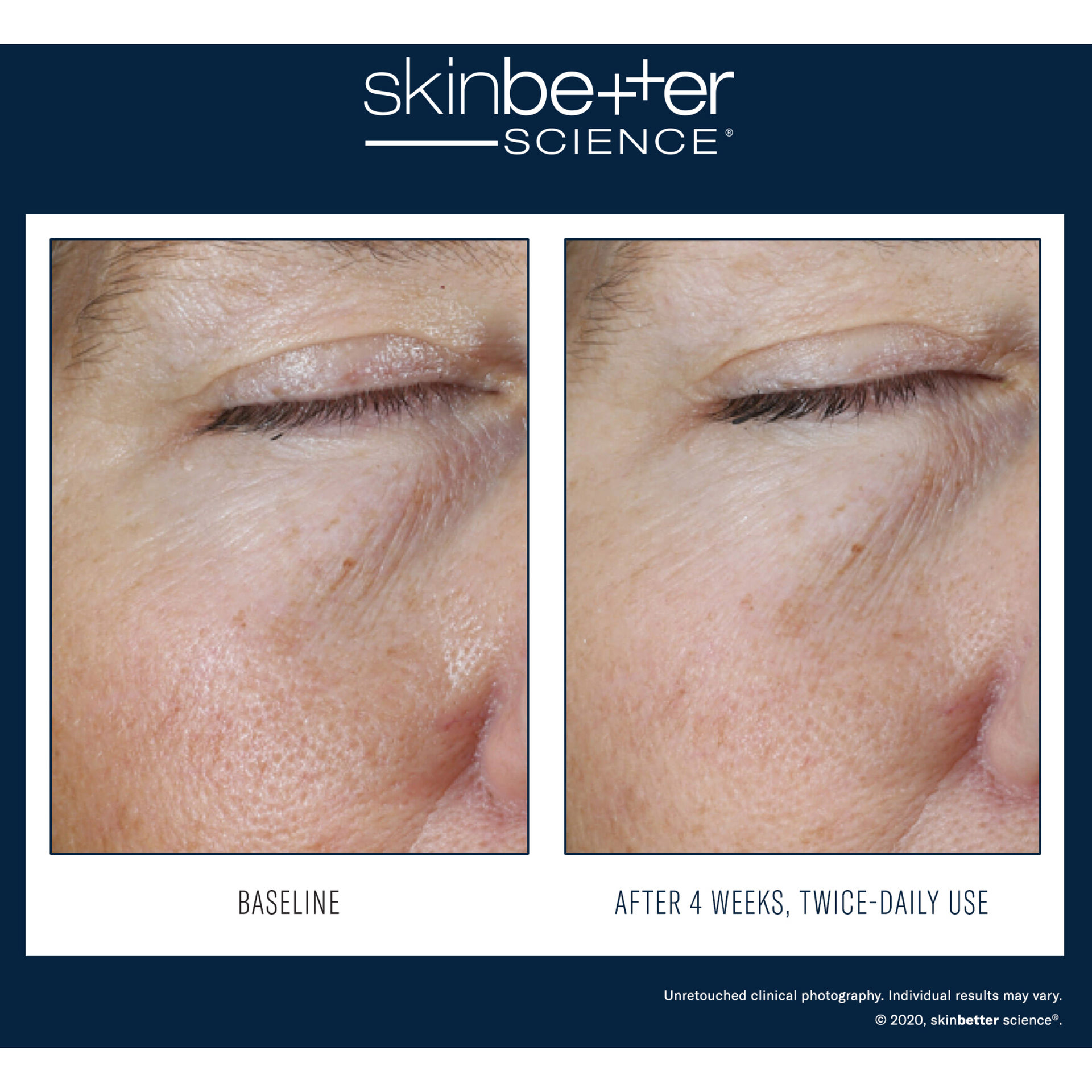 Skinbetter Instant Effect Gel EYE