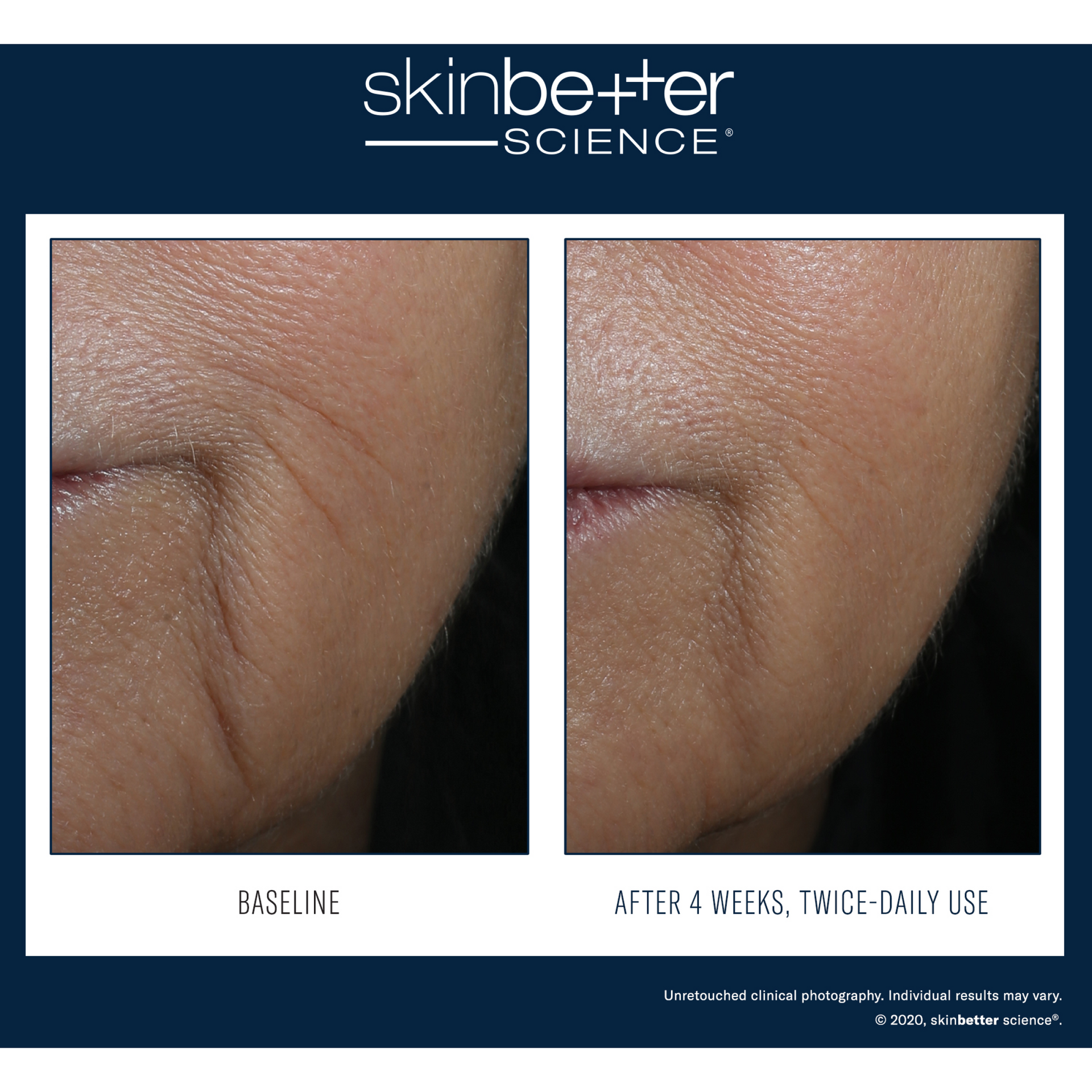 Lignes interfusibles® SkinBetter