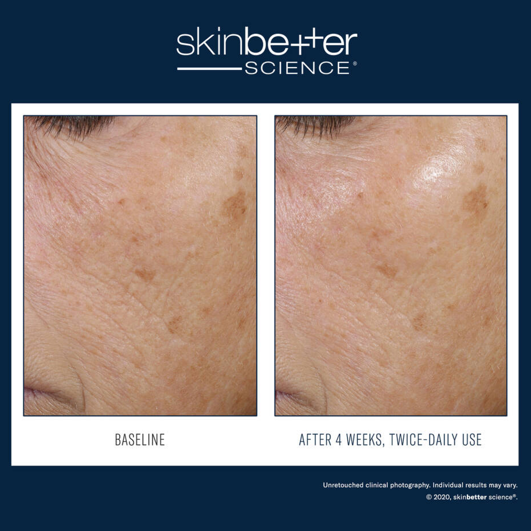 Traitement d’hydratation SkinBetter Trio Rebalancing