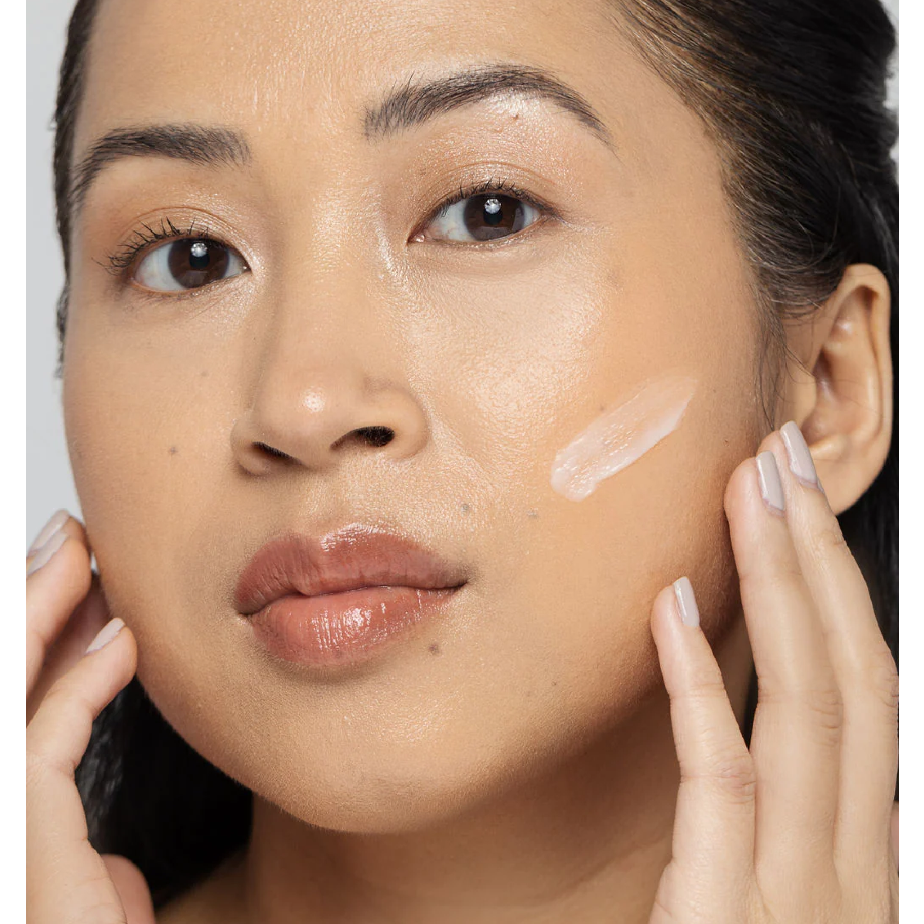 Lotion Vivier pour le traitement de l’acné